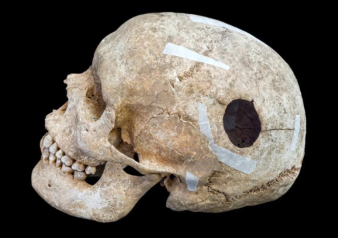 جراحی - پایگاه اطلاع رسانی آژنگ